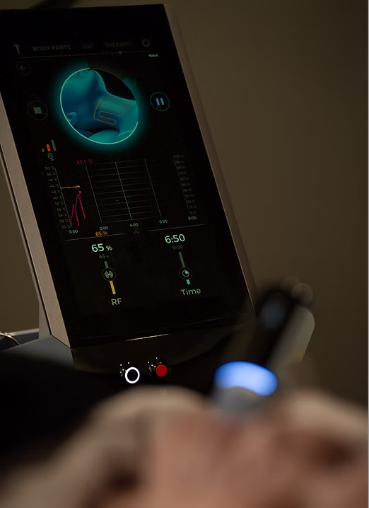 The EXION platform in treatment
